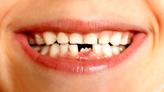 幹細胞を使って歯のエナメル質を再生させることに成功、虫歯の再生技術の実現に期待